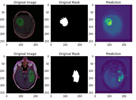 Brain Tumor Segmentation
